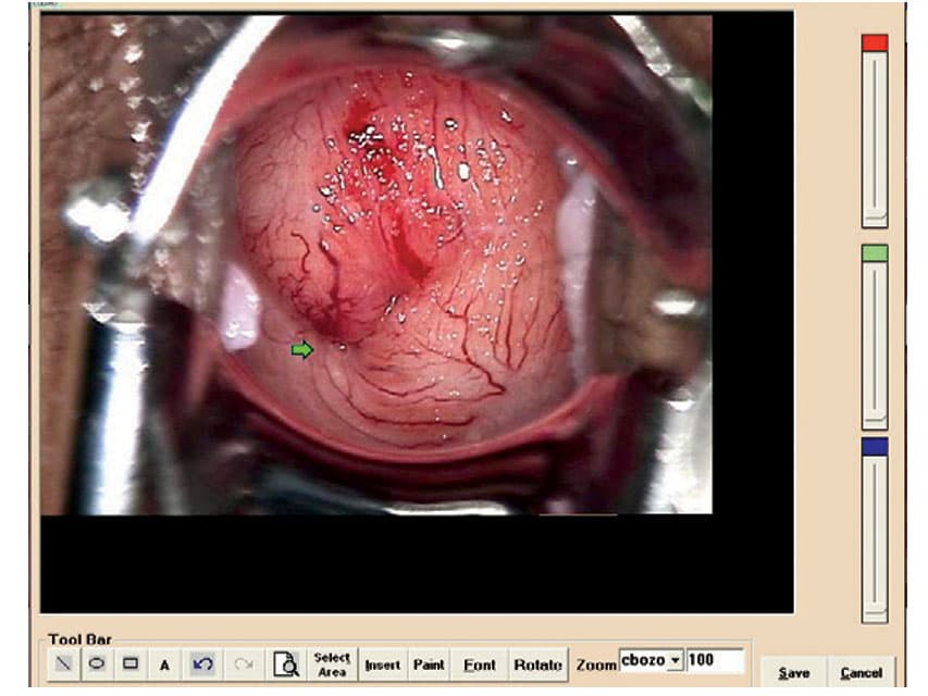 Colposcopy Software pentru Colpro Colposcope - imagine produs