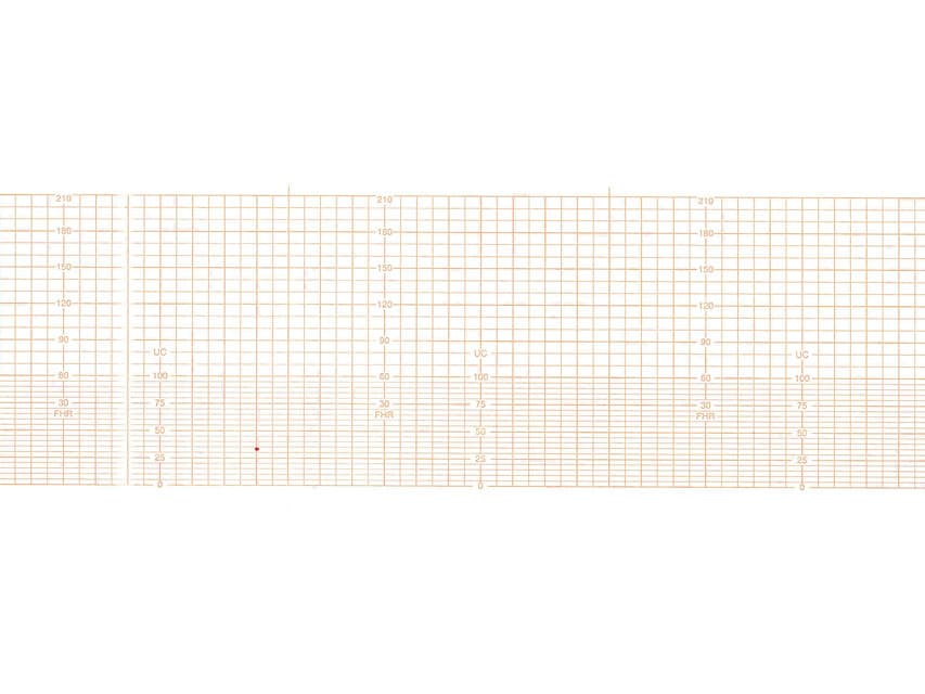 Z-fold hartie 112x100 mm - 150 sheets - produs medical pentru oferta ZESCORP
