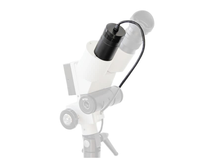Dl1 digital - USB 2.0 camera - produs medical pentru oferta ZESCORP