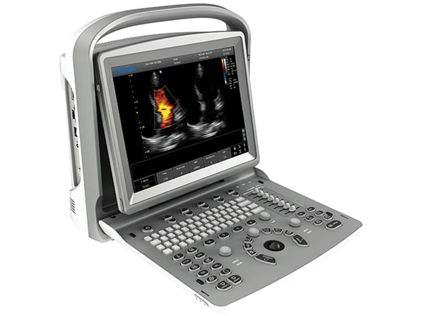 Chison qbit5 ecocolourdoppler - produs medical pentru oferta ZESCORP