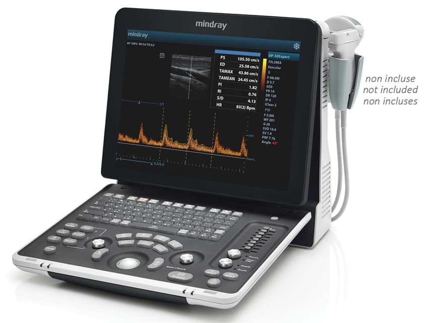 Mindray dp-50 expert portable ecograf cu - produs medical pentru oferta ZESCORP