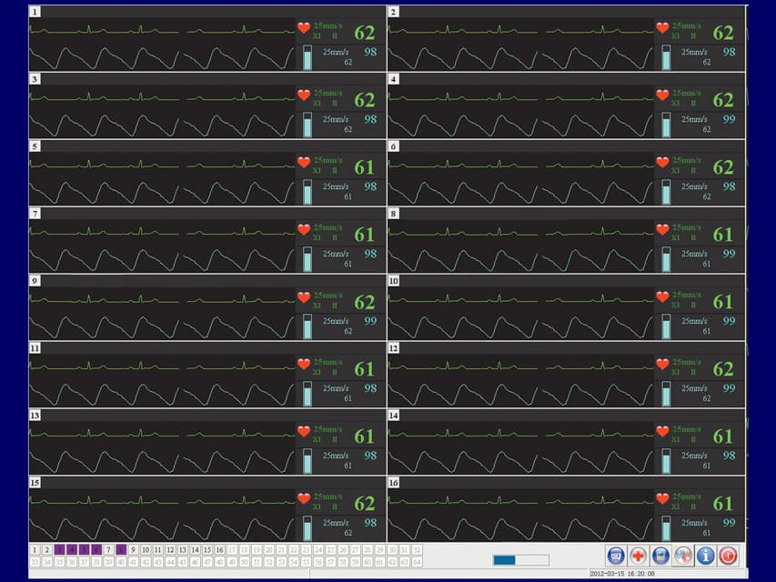 Central station software - produs medical pentru oferta ZESCORP
