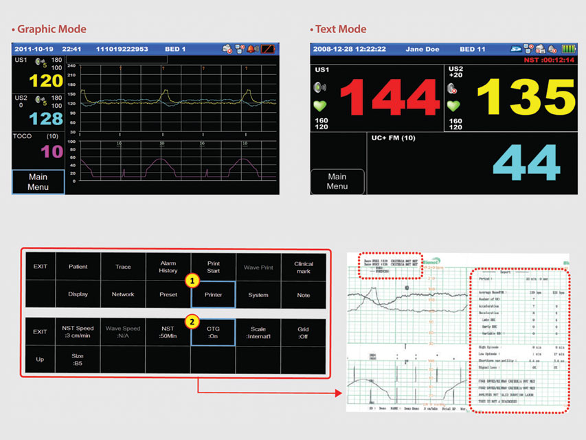 GIMA Fc1400 Simplu Monitor Fetal - imagine produs - imagine 4