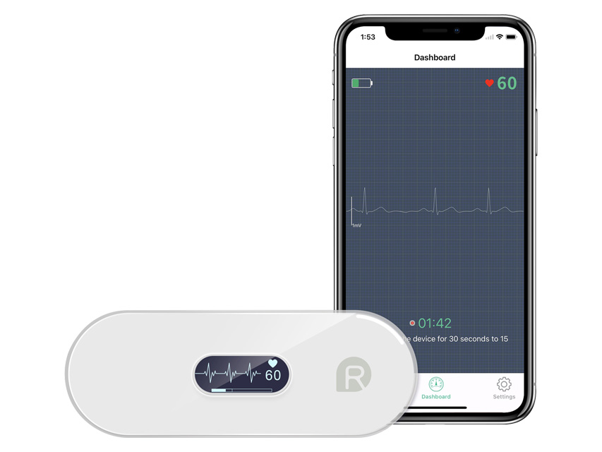 Duoek S Hand - Held Ecg/ekg Monitor - imagine produs